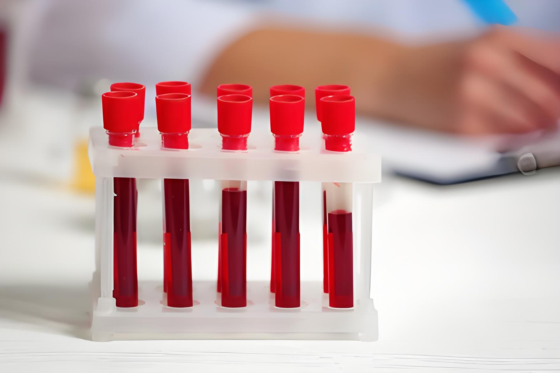 抗筛阴性、主侧交叉不合的原因、处理及输血方案